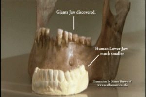 60. Maxilar uriaș descoperit și maxilar uman mult mai mic